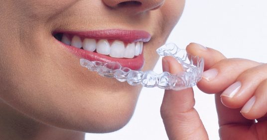 Invisalign®